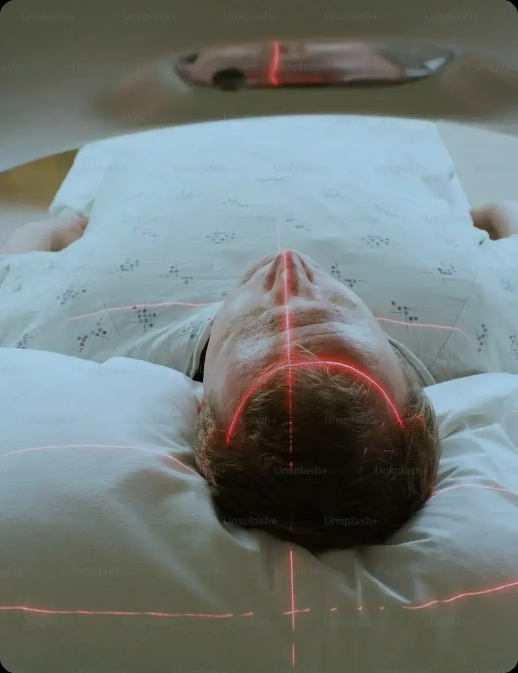 Paciente en máquina de resonancia magnética con láser de posicionamiento en la cabeza