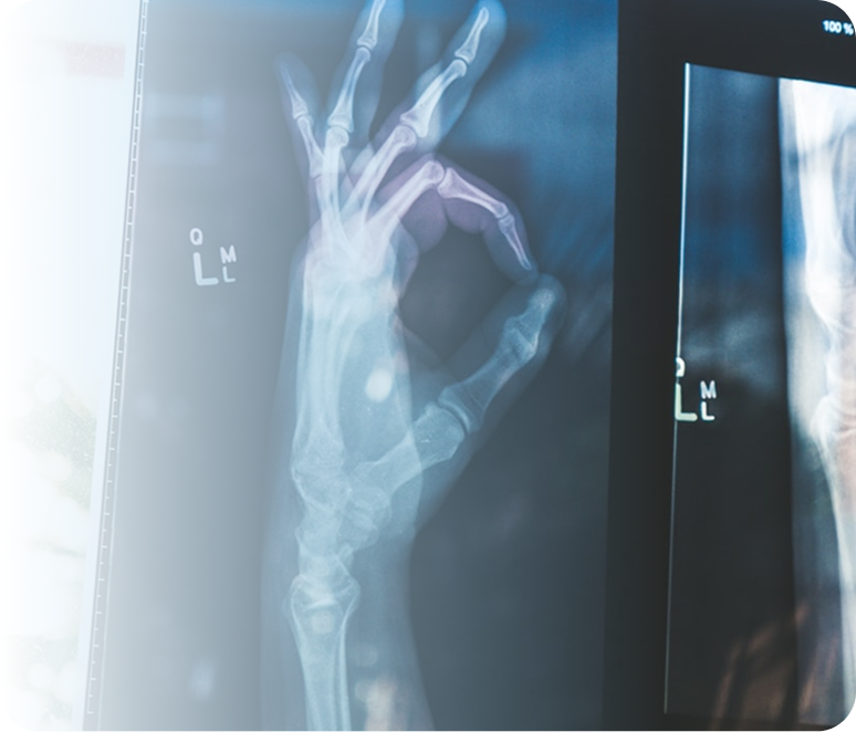 Radiografía de mano mostrando señal de ok en pantalla médica